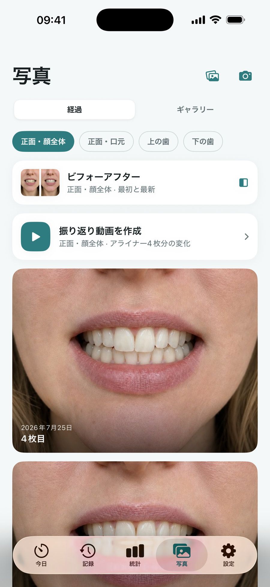 経過写真